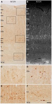 Secretagogin as a marker to distinguish between different neuron types in human frontal and temporal cortex